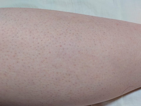 レビュー 男性用除毛クリーム エピラットオム Epilat Homme 口コミ徹底解説と評価 コスメアップデート