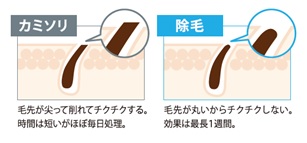 エピラットオム(epilat HOMME) 薬用除毛クリーム脱毛効果