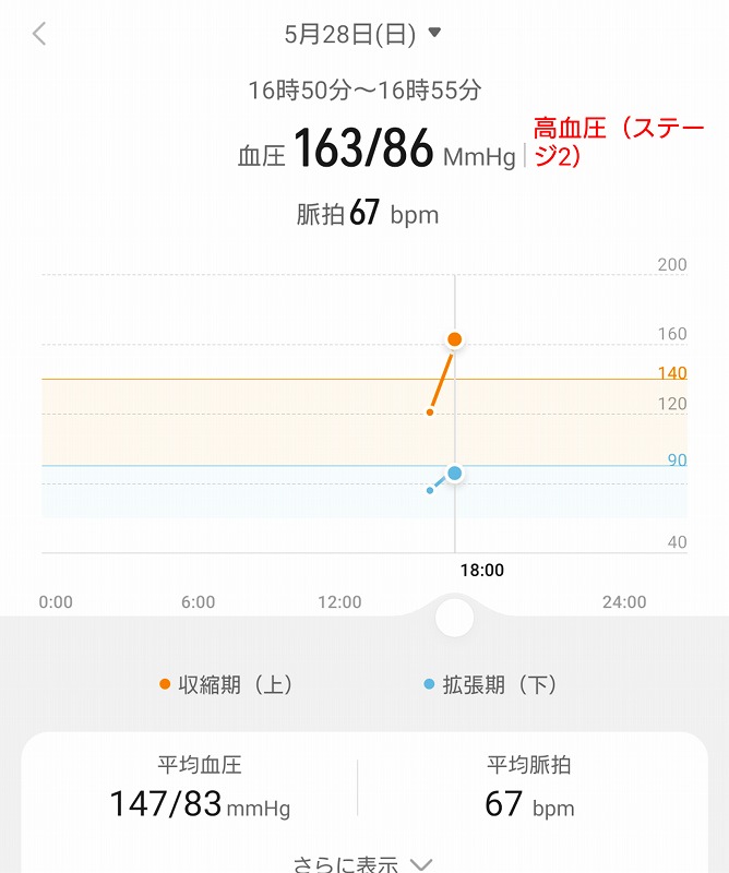 高血圧の実機レビュー】血圧測定機能付きスマートウォッチHUAWEI WATCH D ウェアラブル血圧計の口コミ評価＆評判まとめ